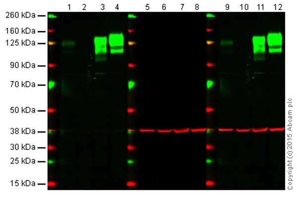 Western blot - Anti-Integrin beta 1 antibody [EP1041Y] - BSA and Azide free (AB192456)