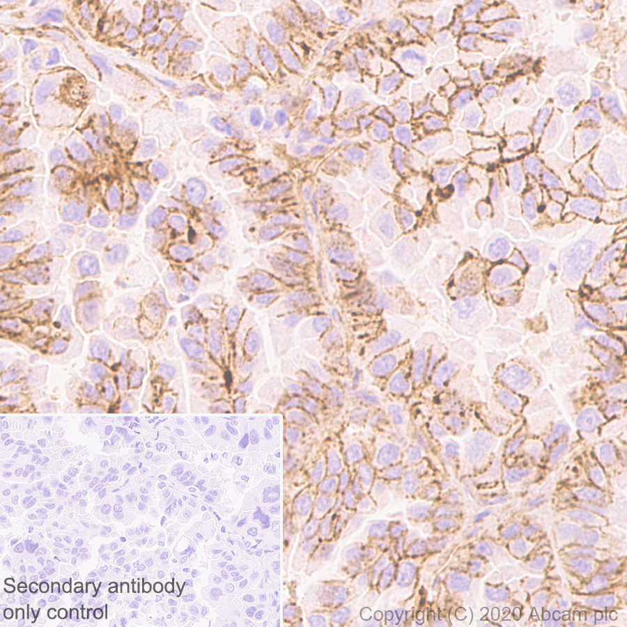 Immunohistochemistry (Formalin/PFA-fixed paraffin-embedded sections) - Anti-Integrin beta 1 antibody [EPR1040Y] (AB134179), expandable thumbnail
