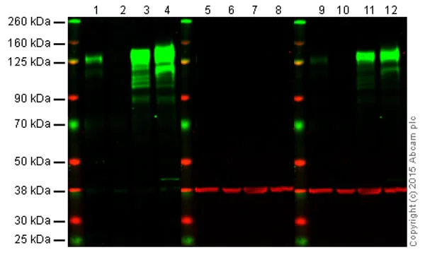 Western blot - Anti-Integrin beta 1 antibody [EPR1040Y] - BSA and Azide free (AB271909)