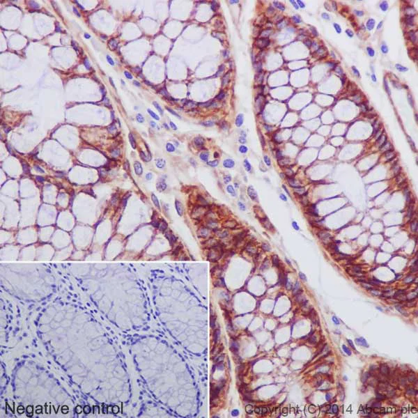 Immunohistochemistry (Formalin/PFA-fixed paraffin-embedded sections) - Anti-Integrin beta 1 antibody [EPR16895] (AB179471)