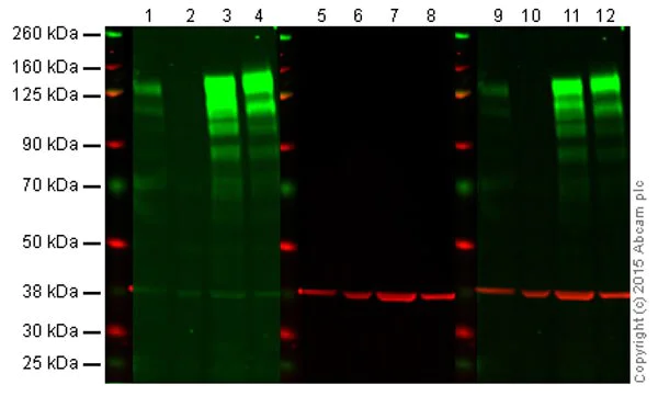 Western blot - Anti-Integrin beta 1 antibody [EPR16895] - BSA and Azide free (AB271931)