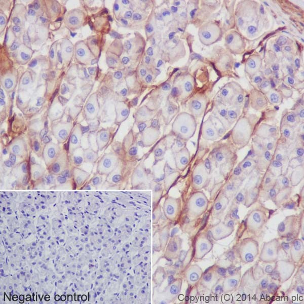 Immunohistochemistry (Formalin/PFA-fixed paraffin-embedded sections) - Anti-Integrin beta 1 antibody [EPR16895] - Low endotoxin, Azide free (AB221776), expandable thumbnail
