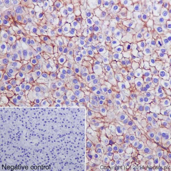 Immunohistochemistry (Formalin/PFA-fixed paraffin-embedded sections) - Anti-Integrin beta 1 antibody [EPR16895] - Low endotoxin, Azide free (AB221776), expandable thumbnail