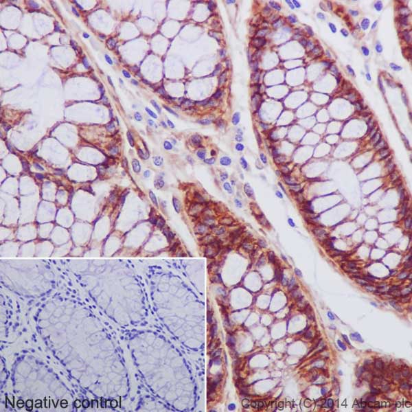 Immunohistochemistry (Formalin/PFA-fixed paraffin-embedded sections) - Anti-Integrin beta 1 antibody [EPR16895] - Low endotoxin, Azide free (AB221776), expandable thumbnail