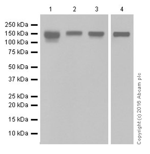 Western blot - Anti-Integrin beta 1 antibody [EPR16896] (AB179472), expandable thumbnail