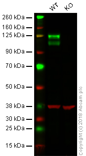 Western blot - Anti-Integrin beta 1 antibody [EPR16896] (AB179472), expandable thumbnail