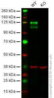 Western blot - Anti-Integrin beta 1 antibody [EPR16896] (AB179472)