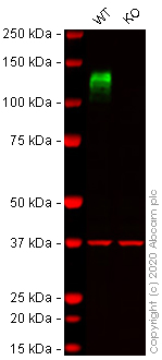 Western blot - Anti-Integrin beta 1 antibody [EPR16896] (AB179472), expandable thumbnail