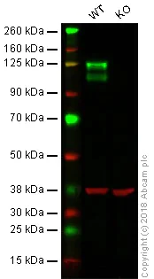 Western blot - Anti-Integrin beta 1 antibody [EPR16896] - BSA and Azide free (AB250101)