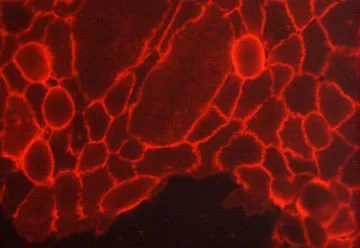 Immunocytochemistry/ Immunofluorescence - Anti-Integrin beta 1 antibody [M032] - Extracellular domain (AB253282)