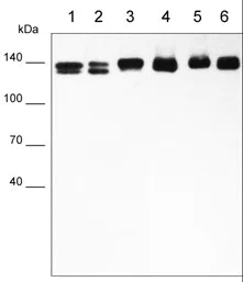 Western blot - Anti-Integrin beta 1 antibody [M032] - Extracellular domain (AB253282)