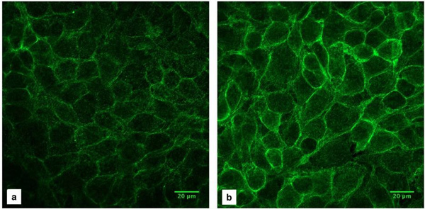 Immunocytochemistry/ Immunofluorescence - Anti-Integrin beta 1 antibody [P5D2] (AB24693), expandable thumbnail