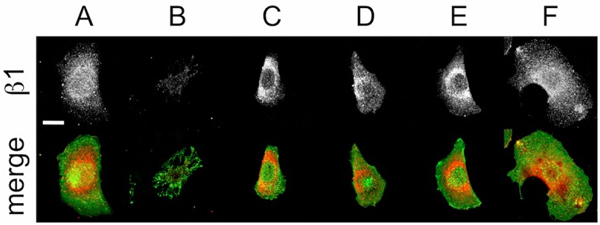 Immunocytochemistry/ Immunofluorescence - Anti-Integrin beta 1 antibody [P5D2] (AB24693), expandable thumbnail