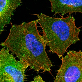 Immunocytochemistry/ Immunofluorescence - Anti-Integrin beta 1 antibody [P5D2] (AB24693), expandable thumbnail