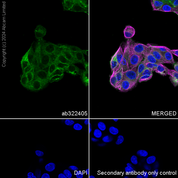 Immunocytochemistry/ Immunofluorescence - Anti-Integrin beta 1 antibody [RM1259] (ab322405), expandable thumbnail
