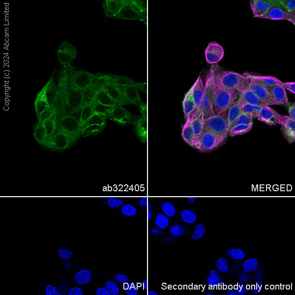 Immunocytochemistry/ Immunofluorescence - Anti-Integrin beta 1 antibody [RM1259] (AB322405)