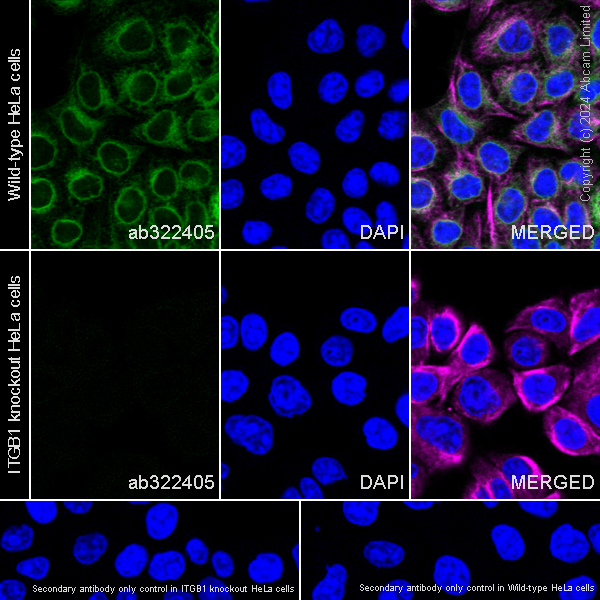 Immunocytochemistry/ Immunofluorescence - Anti-Integrin beta 1 antibody [RM1259] (ab322405), expandable thumbnail