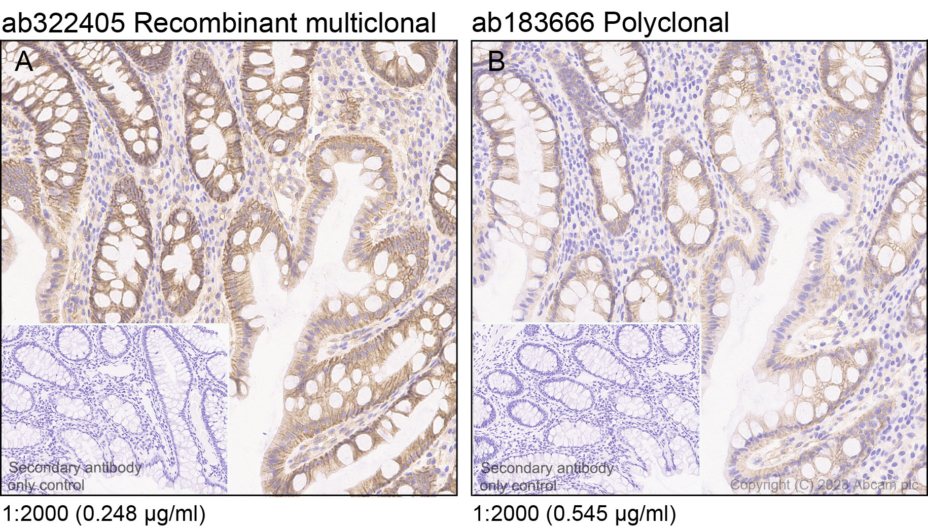 Immunohistochemistry (Formalin/PFA-fixed paraffin-embedded sections) - Anti-Integrin beta 1 antibody [RM1259] (AB322405), expandable thumbnail