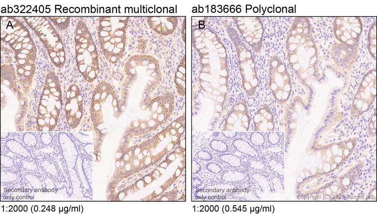Immunohistochemistry (Formalin/PFA-fixed paraffin-embedded sections) - Anti-Integrin beta 1 antibody [RM1259] (AB322405)