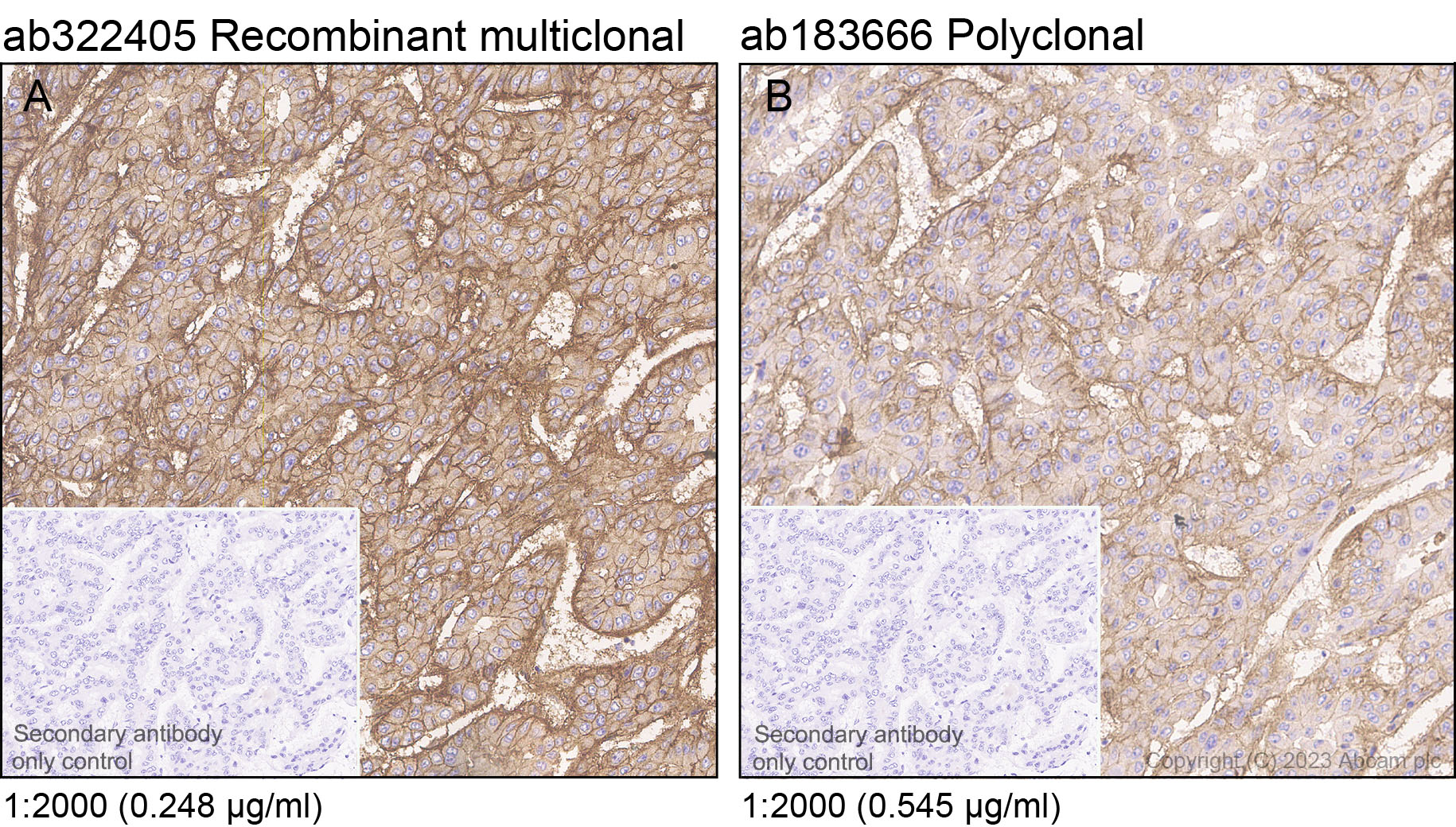 Immunohistochemistry (Formalin/PFA-fixed paraffin-embedded sections) - Anti-Integrin beta 1 antibody [RM1259] (AB322405), expandable thumbnail