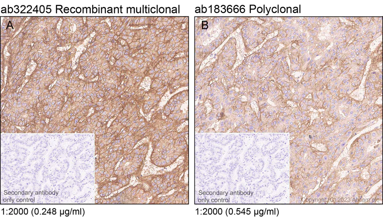 Immunohistochemistry (Formalin/PFA-fixed paraffin-embedded sections) - Anti-Integrin beta 1 antibody [RM1259] (AB322405)