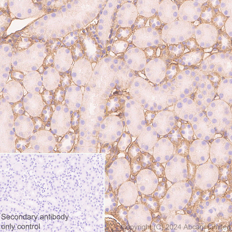 Immunohistochemistry (Formalin/PFA-fixed paraffin-embedded sections) - Anti-Integrin beta 1 antibody [RM1259] (AB322405), expandable thumbnail