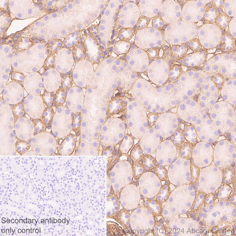 Immunohistochemistry (Formalin/PFA-fixed paraffin-embedded sections) - Anti-Integrin beta 1 antibody [RM1259] (AB322405)