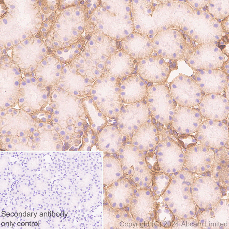 Immunohistochemistry (Formalin/PFA-fixed paraffin-embedded sections) - Anti-Integrin beta 1 antibody [RM1259] (AB322405), expandable thumbnail