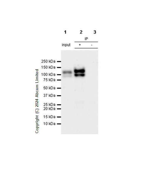Immunoprecipitation - Anti-Integrin beta 1 antibody [RM1259] (ab322405), expandable thumbnail