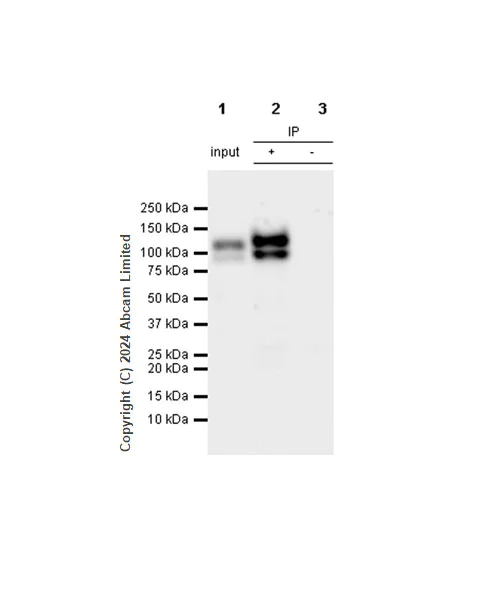 Immunoprecipitation - Anti-Integrin beta 1 antibody [RM1259] (AB322405)