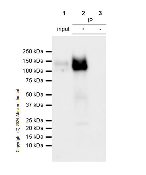 Immunoprecipitation - Anti-Integrin beta 1 antibody [RM1259] (ab322405), expandable thumbnail