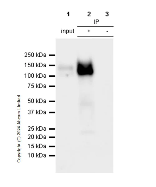 Immunoprecipitation - Anti-Integrin beta 1 antibody [RM1259] (AB322405)
