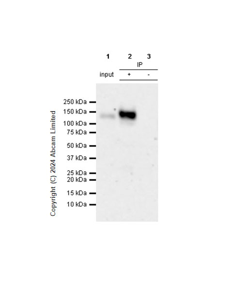Immunoprecipitation - Anti-Integrin beta 1 antibody [RM1259] (ab322405), expandable thumbnail