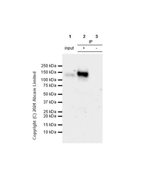 Immunoprecipitation - Anti-Integrin beta 1 antibody [RM1259] (AB322405)
