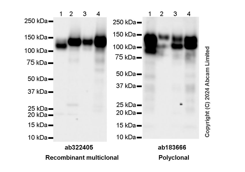 Western blot - Anti-Integrin beta 1 antibody [RM1259] (ab322405), expandable thumbnail