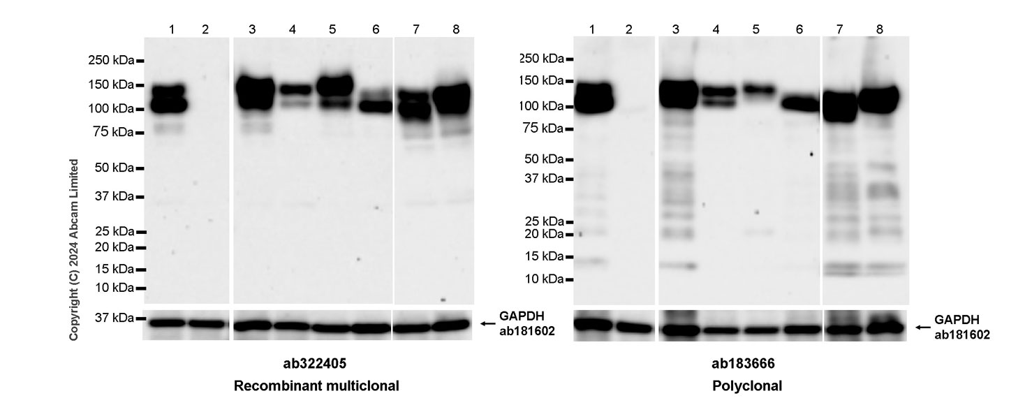 Western blot - Anti-Integrin beta 1 antibody [RM1259] (ab322405), expandable thumbnail