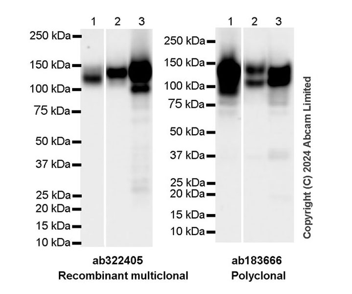 Western blot - Anti-Integrin beta 1 antibody [RM1259] (ab322405), expandable thumbnail