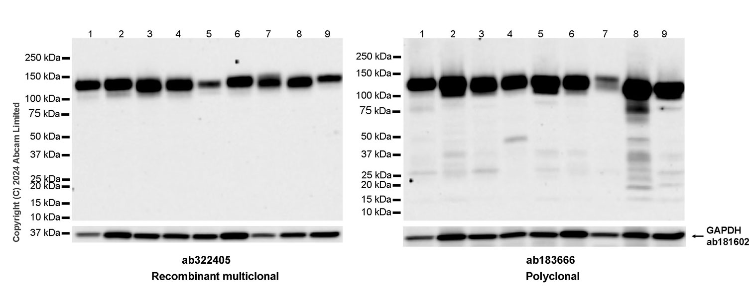 Western blot - Anti-Integrin beta 1 antibody [RM1259] (ab322405), expandable thumbnail