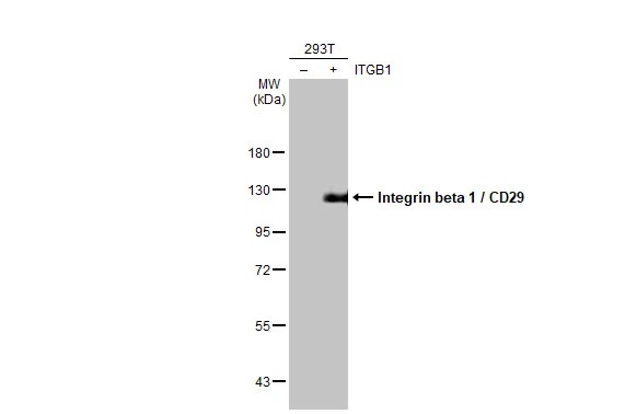 Western blot - Anti-Integrin beta 1/CD29 antibody [HL1255] (AB308384), expandable thumbnail