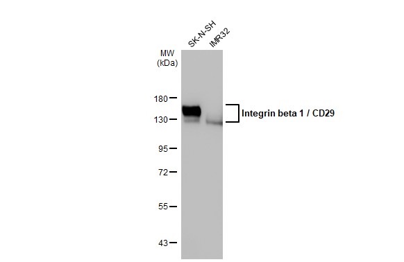 Western blot - Anti-Integrin beta 1/CD29 antibody [HL1255] (AB308384), expandable thumbnail