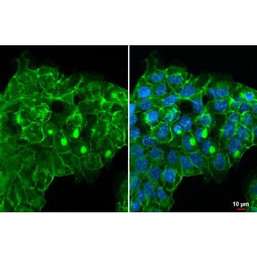 Immunocytochemistry/ Immunofluorescence - Anti-Integrin beta 1 / CD29 antibody [HL1256] (AB317083)