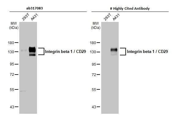 Western blot - Anti-Integrin beta 1 / CD29 antibody [HL1256] (AB317083)