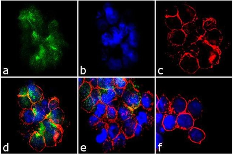 Immunocytochemistry - Anti-Integrin beta 1 (phospho T788 + T789) antibody (AB5189), expandable thumbnail
