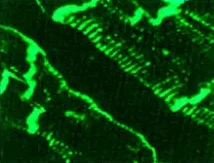 Immunohistochemistry - Anti-Integrin beta 1d antibody [2B1] (AB8991)