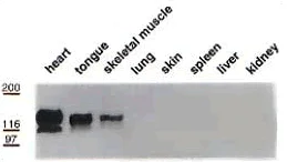 Western blot - Anti-Integrin beta 1d antibody [2B1] (AB8991)