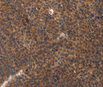 Immunohistochemistry (Formalin/PFA-fixed paraffin-embedded sections) - Anti-Integrin beta 3 antibody (AB197662), expandable thumbnail