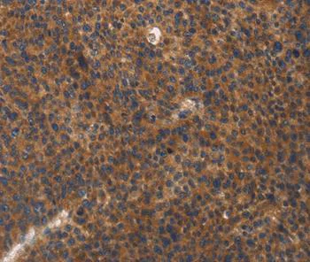Immunohistochemistry (Formalin/PFA-fixed paraffin-embedded sections) - Anti-Integrin beta 3 antibody (AB197662)