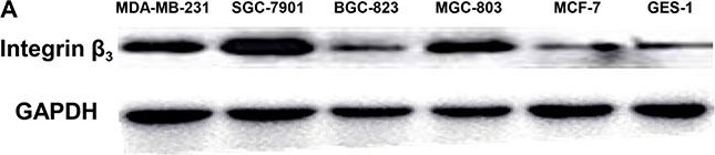 Western blot - Anti-Integrin beta 3 antibody (AB197662), expandable thumbnail