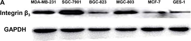 Western blot - Anti-Integrin beta 3 antibody (AB197662)