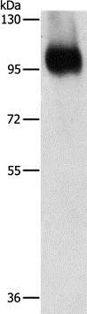 Western blot - Anti-Integrin beta 3 antibody (AB197662)